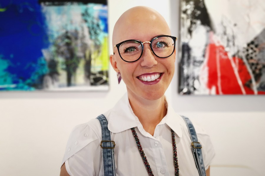 Katrin aus St. Gallen lebt seit mehreren Jahren mit Alopezie, was ihre Haare ausfallen lässt.
